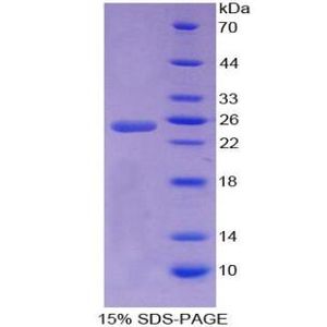 Recombinant Human A1CF Protein, His-tagged