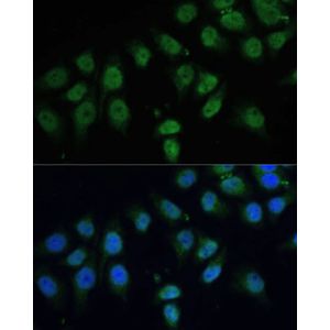 Anti-CPS1 antibody