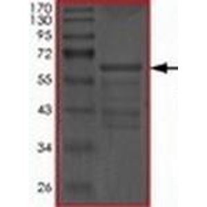 Pre-coated 384 well Microplate SimpleStep ELISA®(AB203359)