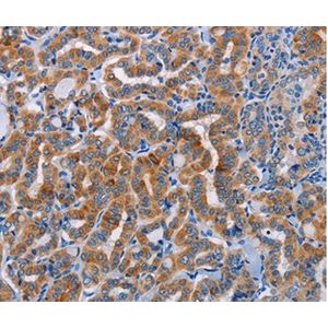 Anti-Apolipoprotein E antibody [EPR19392](AB183597)