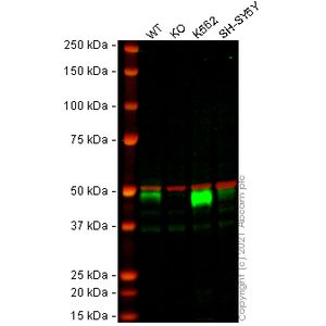 Anti-TGF beta 1 antibody [EPR21143]