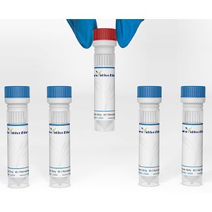 Mouse Anti-p24 (HIV-1) Recombinant Antibody (50B9)