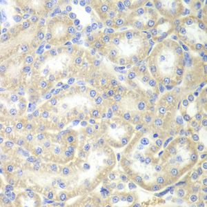 Anti-EPB41 antibody