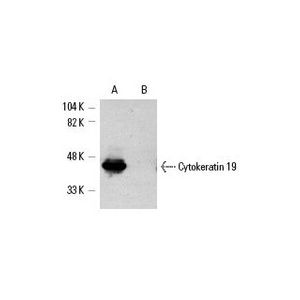 Cytokeratin 19 (A53-B/A2) FITC