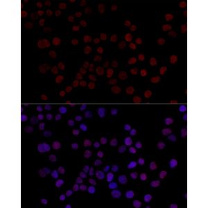 Anti-HNRNPL antibody