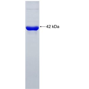 Recombinant Human ADRBK1 protein, His-tagged