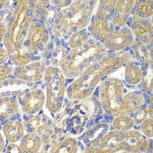 Anti-BAIAP2 antibody
