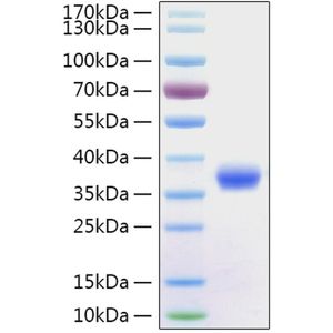2019-nCoV Spike RBD Protein