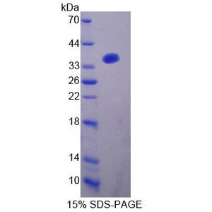 Recombinant Human AKAP12 protein, His-tagged