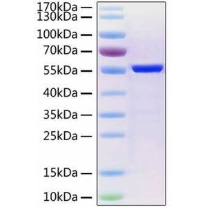 2019-nCoV Nucleocapsid Protein