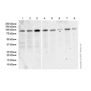 Human PreAlbumin ELISA Kit (Transthyretin)(AB108895)