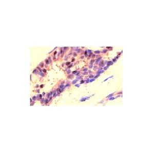 Estrogen Receptor alpha (C-311) Alexa Fluor® 546