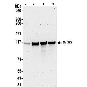 Anti-CDKN2A/p16INK4a antibody [2D9A12](AB54210)