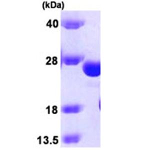 Anti-gamma H2A.X (phospho S139) antibody(AB2893)