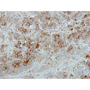 Anti-LDL Receptor antibody [EP1553Y](AB52818)