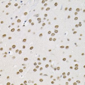 Anti-Smarcd1 antibody