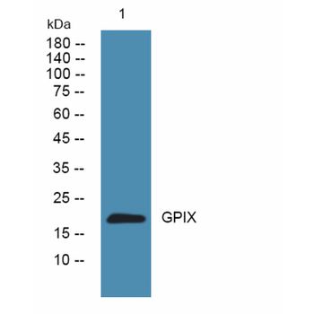 Anti-GPIX antibody | Science Company | Labroots