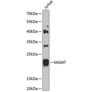 Anti-MGMT antibody
