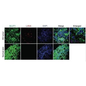 Anti-Glucose Transporter GLUT1 antibody [EPR3915]
