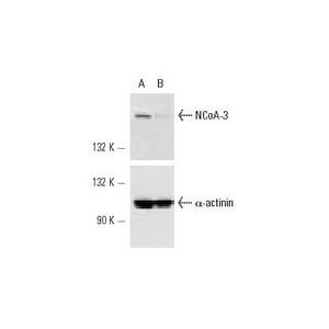 NCoA-3 siRNA (h)