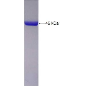 Recombinant Human ADH1B protein, His-tagged