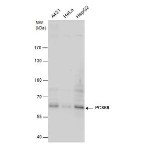 Anti-Firefly Luciferase antibody [EPR17790](AB185924)