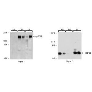 PhosphoCruzTM Protein Purification System