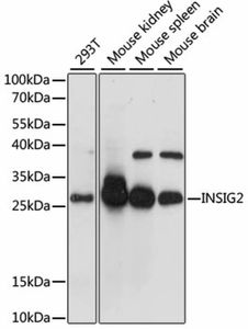 Anti-INSIG2 antibody | Science Company | Labroots