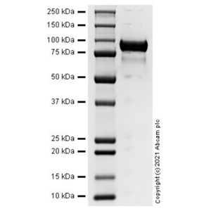 Human Pro-Collagen I alpha 1 ELISA Kit(AB210966)