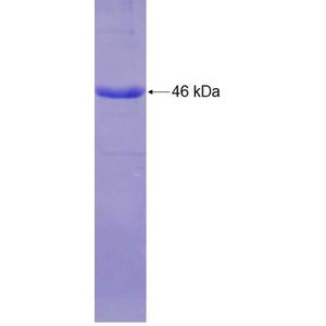 Recombinant Human ALDH5A1 protein, His-tagged
