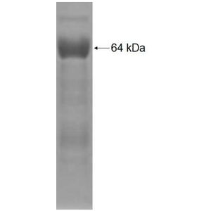 Recombinant Human ALS2CR8 protein, GST-tagged