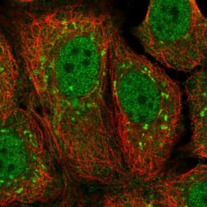 Human Prealbumin ELISA Kit(AB231920)