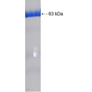 Recombinant Human AKR1A1 protein, GST-tagged