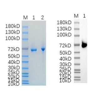 Recombinant Human ALPP Protein, His tagged
