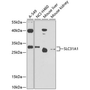 Anti-SLC31A1 antibody