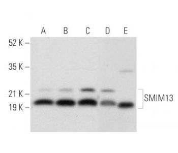 SMIM13 E 6 Alexa Fluor 488 Science Company Labroots