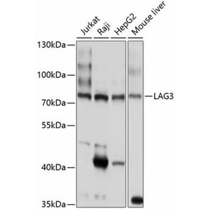 Anti-LAG3 antibody