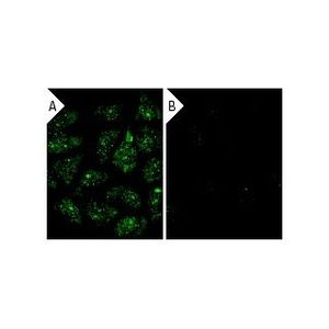 γ Tubulin siRNA (h)