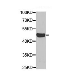 Anti-FMRP antibody(AB17722)
