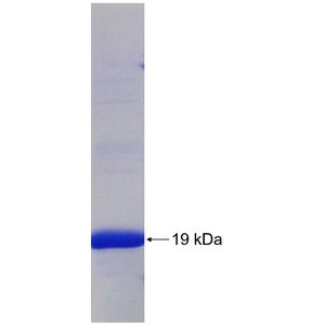 Recombinant Human ABCB1 protein, His-tagged