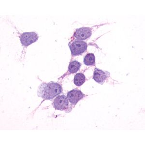 Mouse Cathepsin B ELISA Kit(AB119585)