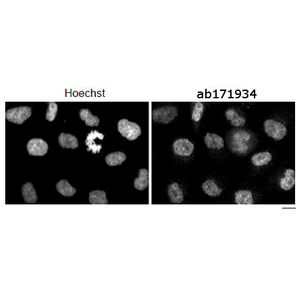 Human IgM ELISA Kit(AB214568)
