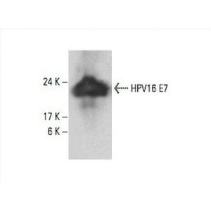 HPV16 E7 (TVG710Y) HRP