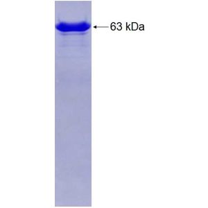 Recombinant Human ACAT2 protein, GST-tagged