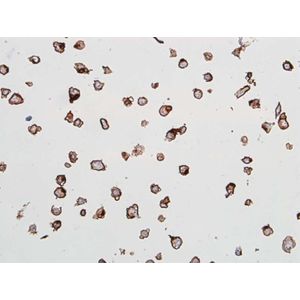 Anti-Nectin-4 antibody [EPR15613-68](AB192033)