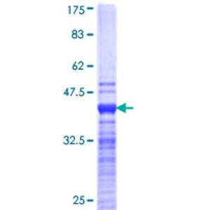 Anti-Myeloperoxidase antibody [EPR20257](AB208670)