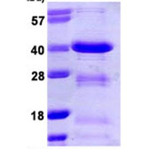 Anti-TROP2 antibody [EPR20043](AB214488)