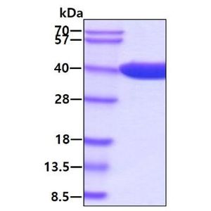 Active Recombinant E. coli AmpC protein, His-tagged