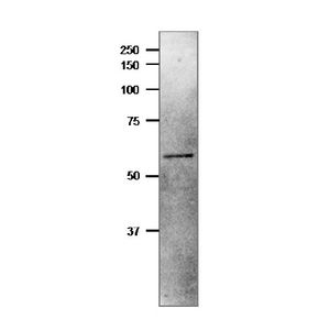 Anti-CDKN2A/p16INK4a antibody [EPR20418](AB211542)