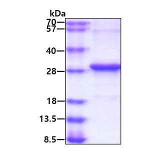 Recombinant Human ADIPOQ Protein